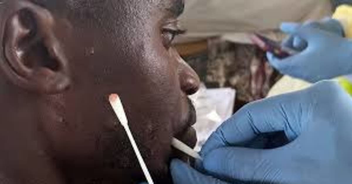 Ghana Records 21 New Mpox Cases, Total Hits 467 Nationwide